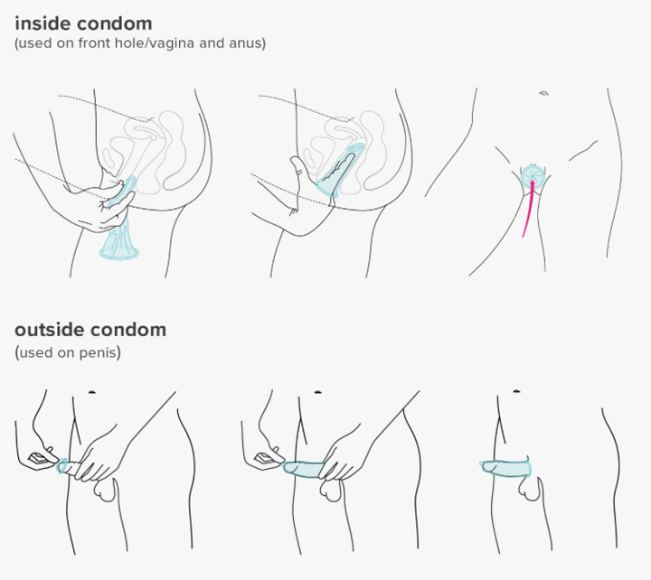 inside and outside condoms